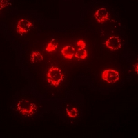 TLR8 Antibody - Immunofluorescent analysis of CD288 staining in MCF7 cells. Formalin-fixed cells were permeabilized with 0.1% Triton X-100 in TBS for 5-10 minutes and blocked with 3% BSA-PBS for 30 minutes at room temperature. Cells were probed with the primary antibody in 3% BSA-PBS and incubated overnight at 4 deg C in a humidified chamber. Cells were washed with PBST and incubated with a DyLight 594-conjugated secondary antibody (red) in PBS at room temperature in the dark.