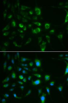 TLR8 Antibody - Immunofluorescence analysis of MCF-7 cells using TLR8 antibody. Blue: DAPI for nuclear staining.