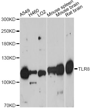 TLR8 Antibody - Western blot analysis of extracts of various cell lines, using TLR8 antibody at 1:1000 dilution. The secondary antibody used was an HRP Goat Anti-Rabbit IgG (H+L) at 1:10000 dilution. Lysates were loaded 25ug per lane and 3% nonfat dry milk in TBST was used for blocking. An ECL Kit was used for detection and the exposure time was 90s.