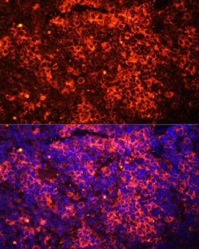 TLR8 Antibody - Immunofluorescence analysis of Mouse spleen using TLR8 Polyclonal Antibody at dilution of 1:100 (40x lens).Blue: DAPI for nuclear staining.