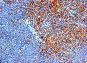 TLR9 Antibody - Immunohistochemistry of paraffin-embedded mouse thymus with Goat anti-mouse CD289