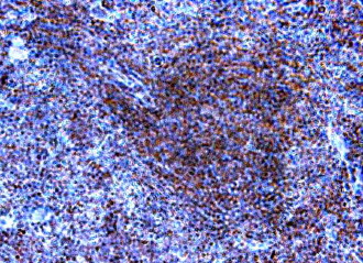 TLR9 Antibody - IHC of TLR9 antibody. Formalin-fixed, paraffin-embedded mouse spleen.