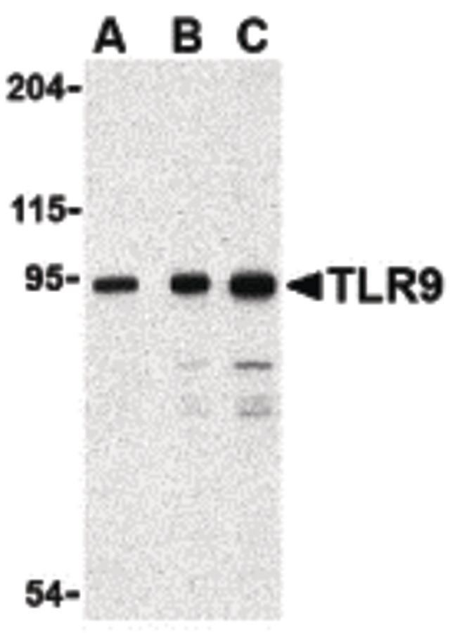 TLR9 Antibody - Western blot of TLR9 in Jurkat cell lysate with TLR9 antibody at (A) 0.5, (B) 1 and (C) 2 ug/ml.