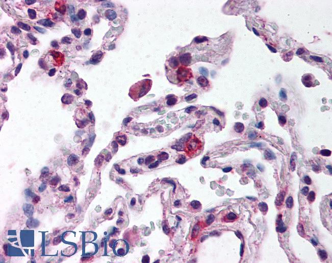 TLR9 Antibody - Anti-TLR9 antibody IHC of human lung. Immunohistochemistry of formalin-fixed, paraffin-embedded tissue after heat-induced antigen retrieval. Antibody concentration 10 ug/ml.