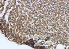 TLR9 Antibody - 1:100 staining mouse liver tissue by IHC-P. The sample was formaldehyde fixed and a heat mediated antigen retrieval step in citrate buffer was performed. The sample was then blocked and incubated with the antibody for 1.5 hours at 22°C. An HRP conjugated goat anti-rabbit antibody was used as the secondary.