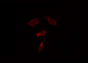 TLR9 Antibody - Staining HepG2 cells by IF/ICC. The samples were fixed with PFA and permeabilized in 0.1% Triton X-100, then blocked in 10% serum for 45 min at 25°C. The primary antibody was diluted at 1:200 and incubated with the sample for 1 hour at 37°C. An Alexa Fluor 594 conjugated goat anti-rabbit IgG (H+L) Ab, diluted at 1/600, was used as the secondary antibody.