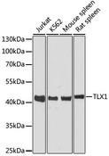 TLX1 / HOX11 Antibody - Western blot analysis of extracts of various cell lines, using TLX1 antibody at 1:3000 dilution. The secondary antibody used was an HRP Goat Anti-Rabbit IgG (H+L) at 1:10000 dilution. Lysates were loaded 25ug per lane and 3% nonfat dry milk in TBST was used for blocking. An ECL Kit was used for detection and the exposure time was 90s.