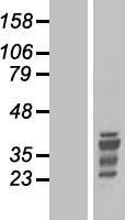 TLX1 / HOX11 Protein - Western validation with an anti-DDK antibody * L: Control HEK293 lysate R: Over-expression lysate