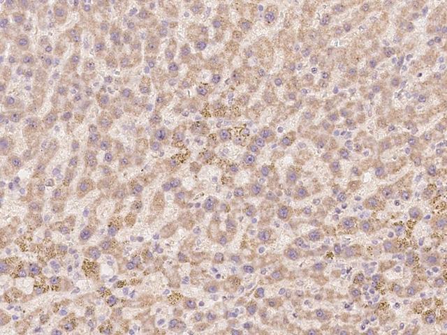 TLX2 / NCX Antibody - Immunochemical staining of human TLX2 in human liver with rabbit polyclonal antibody at 1:100 dilution, formalin-fixed paraffin embedded sections.