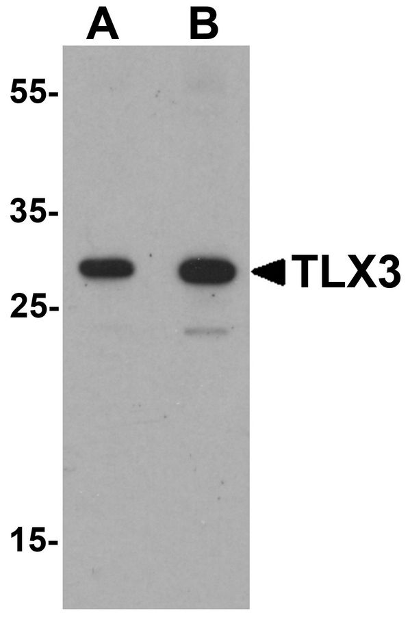 TLX3 Antibody - Western blot analysis of TLX3 in human spleen tissue lysate with TLX3 antibody at (A) 0.5 and (B) 1 ug/ml.