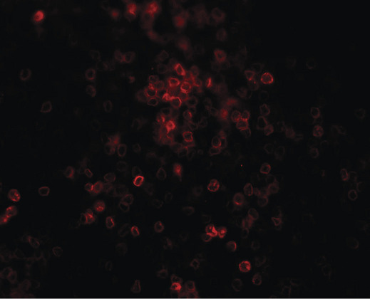 TLX3 Antibody - Immunofluorescence of TLX3 in human spleen tissue with TLX3 antibody at 20 ug/ml.