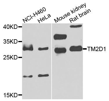 TM2D1 / BBP Antibody - Western blot analysis of extracts of various cells.