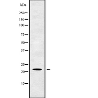 TM2D1 / BBP Antibody - Western blot analysis of TM2D1 using K562 whole cells lysates