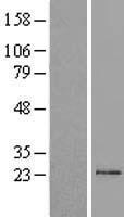 TM2D1 / BBP Protein - Western validation with an anti-DDK antibody * L: Control HEK293 lysate R: Over-expression lysate