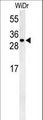 TM2D3 Antibody - TM2D3 Antibody western blot of WiDr cell line lysates (35 ug/lane). The TM2D3 antibody detected the TM2D3 protein (arrow).