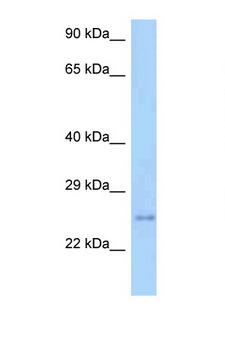 TM2D3 Antibody - TM2D3 antibody Western blot of Mouse Heart lysate. Antibody concentration 1 ug/ml.  This image was taken for the unconjugated form of this product. Other forms have not been tested.