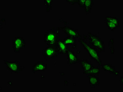 TM2D3 Antibody - Immunofluorescent analysis of Hela cells using TM2D3 Antibody at dilution of 1:100 and Alexa Fluor 488-congugated AffiniPure Goat Anti-Rabbit IgG(H+L)