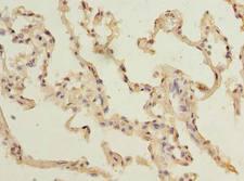 TM4SF1 Antibody - Immunohistochemistry of paraffin-embedded human lung tissue using antibody at dilution of 1:100.