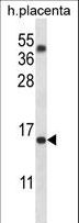 TM4SF18 Antibody - TM4SF18 Antibody western blot of human placenta tissue lysates (35 ug/lane). The TM4SF18 antibody detected the TM4SF18 protein (arrow).