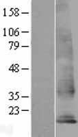 TM4SF18 Protein - Western validation with an anti-DDK antibody * L: Control HEK293 lysate R: Over-expression lysate