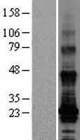 TM4SF19 Protein - Western validation with an anti-DDK antibody * L: Control HEK293 lysate R: Over-expression lysate
