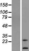 TM4SF20 Protein - Western validation with an anti-DDK antibody * L: Control HEK293 lysate R: Over-expression lysate