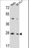 TM4SF4 Antibody - T4S4 Antibody western blot of A549,ZR-75-1 cell line lysates (35 ug/lane). The T4S4 antibody detected the T4S4 protein (arrow).