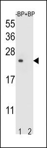 TM4SF4 Antibody - Western blot of T4S4 Antibody antibody pre-incubated without(lane 1) and with(lane 2) blocking peptide in liver cell line lysate. T4S4 Antibody (arrow) was detected using the purified Pab