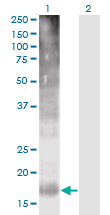 TM4SF4 Antibody - Western blot of TM4SF4 expression in transfected 293T cell line by TM4SF4 monoclonal antibody (M03), clone 4E6.