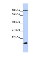 TM4SF4 Antibody - TM4SF4 antibody Western blot of Jurkat lysate. This image was taken for the unconjugated form of this product. Other forms have not been tested.