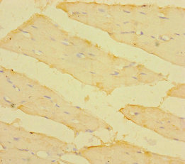 TM4SF5 Antibody - Immunohistochemistry of paraffin-embedded human skeletal muscle tissue using TM4SF5 Antibody at dilution of 1:100