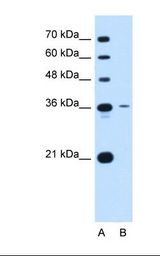 TM4SF9 / TSPAN5 Antibody - Lane A: Marker. Lane B: Jurkat cell lysate. Antibody concentration: 0.25 ug/ml. Gel concentration: 12%.  This image was taken for the unconjugated form of this product. Other forms have not been tested.