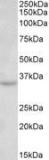 TM4SF9 / TSPAN5 Antibody - TSPAN5 antibody (0.3 ug/ml) staining of Mouse Brain lysate (35 ug protein in RIPA buffer). Primary incubation was 1 hour. Detected by chemiluminescence.