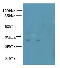 TM4SF9 / TSPAN5 Antibody - Western blot. All lanes: TSPAN5 antibody at 1.2 ug/ml. Lane 1: Jurkat whole cell lysate. Lane 2: A549 whole cell lysate. Secondary Goat polyclonal to Rabbit IgG at 1:10000 dilution. Predicted band size: 30 kDa. Observed band size: 30 kDa.