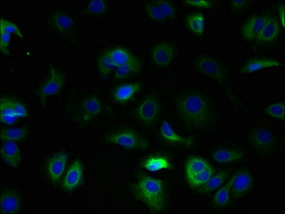 TM4SF9 / TSPAN5 Antibody - Immunofluorescent analysis of MCF-7 cells using TSPAN5 Antibody at dilution of 1:100 and Alexa Fluor 488-congugated AffiniPure Goat Anti-Rabbit IgG(H+L)