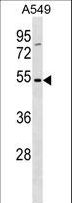TM6SF1 Antibody - TM6SF1 Antibody western blot of A549 cell line lysates (35 ug/lane). The TM6SF1 antibody detected the TM6SF1 protein (arrow).
