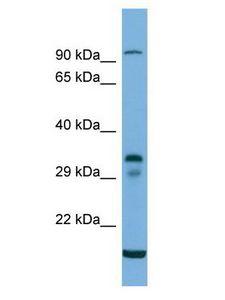 TM6SF2 Antibody - TM6SF2 antibody Western Blot of 293T. Antibody dilution: 1 ug/ml.  This image was taken for the unconjugated form of this product. Other forms have not been tested.