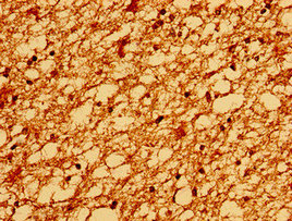 TM6SF2 Antibody - Immunohistochemistry image of paraffin-embedded human brain tissue at a dilution of 1:100