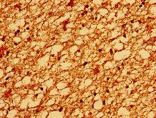 TM6SF2 Antibody - Immunohistochemistry image of paraffin-embedded human brain tissue at a dilution of 1:100