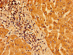 TM6SF2 Antibody - Immunohistochemistry image of paraffin-embedded human liver tissue at a dilution of 1:100