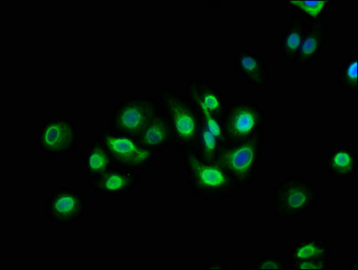 TM6SF2 Antibody - Immunofluorescence staining of HepG2 cells with TM6SF2 Antibody at 1:133, counter-stained with DAPI. The cells were fixed in 4% formaldehyde, permeabilized using 0.2% Triton X-100 and blocked in 10% normal Goat Serum. The cells were then incubated with the antibody overnight at 4°C. The secondary antibody was Alexa Fluor 488-congugated AffiniPure Goat Anti-Rabbit IgG(H+L).