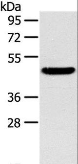 TM7SF2 Antibody - Western blot analysis of Mouse liver tissue, using TM7SF2 Polyclonal Antibody at dilution of 1:400.