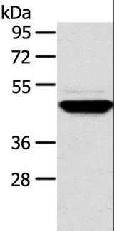 TM7SF2 Antibody - Western blot analysis of Human fetal brain tissue, using TM7SF2 Polyclonal Antibody at dilution of 1:500.