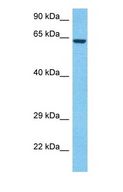 TM7SF3 Antibody - Western blot of TM7S3 Antibody with human MCF7 Whole Cell lysate.  This image was taken for the unconjugated form of this product. Other forms have not been tested.