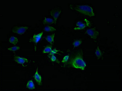 TM7SF3 Antibody - Immunofluorescent analysis of U251 cells using TM7SF3 Antibody at dilution of 1:100 and Alexa Fluor 488-congugated AffiniPure Goat Anti-Rabbit IgG(H+L)