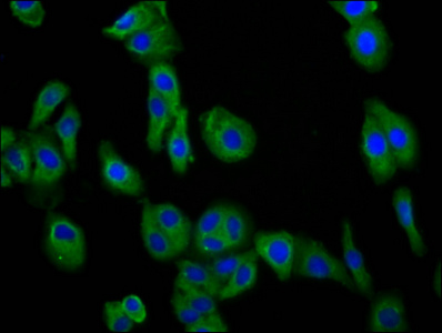 TM7SF4 / DC-STAMP Antibody - Immunofluorescence staining of HepG2 cells diluted at 1:66, counter-stained with DAPI. The cells were fixed in 4% formaldehyde, permeabilized using 0.2% Triton X-100 and blocked in 10% normal Goat Serum. The cells were then incubated with the antibody overnight at 4°C.The Secondary antibody was Alexa Fluor 488-congugated AffiniPure Goat Anti-Rabbit IgG (H+L).