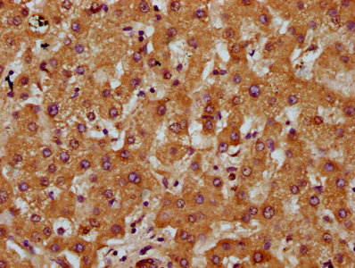 TM7SF4 / DC-STAMP Antibody - Immunohistochemistry Dilution at 1:200 and staining in paraffin-embedded human liver tissue performed on a Leica BondTM system. After dewaxing and hydration, antigen retrieval was mediated by high pressure in a citrate buffer (pH 6.0). Section was blocked with 10% normal Goat serum 30min at RT. Then primary antibody (1% BSA) was incubated at 4°C overnight. The primary is detected by a biotinylated Secondary antibody and visualized using an HRP conjugated SP system.