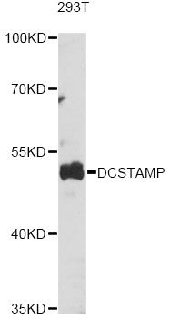 TM7SF4 / DC-STAMP Antibody - Western blot analysis of extracts of various cell lines, using DCSTAMP antibody at 1:1000 dilution. The secondary antibody used was an HRP Goat Anti-Rabbit IgG (H+L) at 1:10000 dilution. Lysates were loaded 25ug per lane and 3% nonfat dry milk in TBST was used for blocking. An ECL Kit was used for detection and the exposure time was 90s.