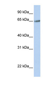 TM9SF1 Antibody - TM9SF1 antibody Western blot of Fetal Muscle lysate. This image was taken for the unconjugated form of this product. Other forms have not been tested.