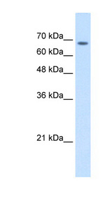 TM9SF1 Antibody - TM9SF1 antibody ARP44685_T100-NP_006396-TM9SF1(transmembrane 9 superfamily member 1) Antibody Western blot of Jurkat lysate.  This image was taken for the unconjugated form of this product. Other forms have not been tested.